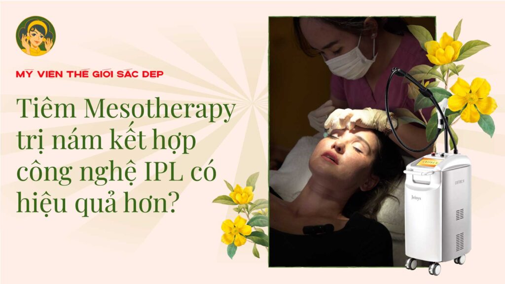 Read more about the article Tiêm Mesotherapy trị nám kết hợp công nghệ IPL có hiệu quả hơn?