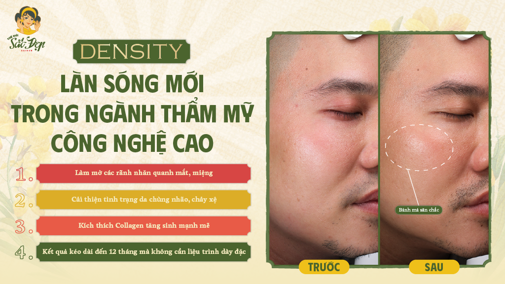 cong-nghe-san-da-density-lan-song-moi-trong-nganh-tham-my-cong-nghe-cao