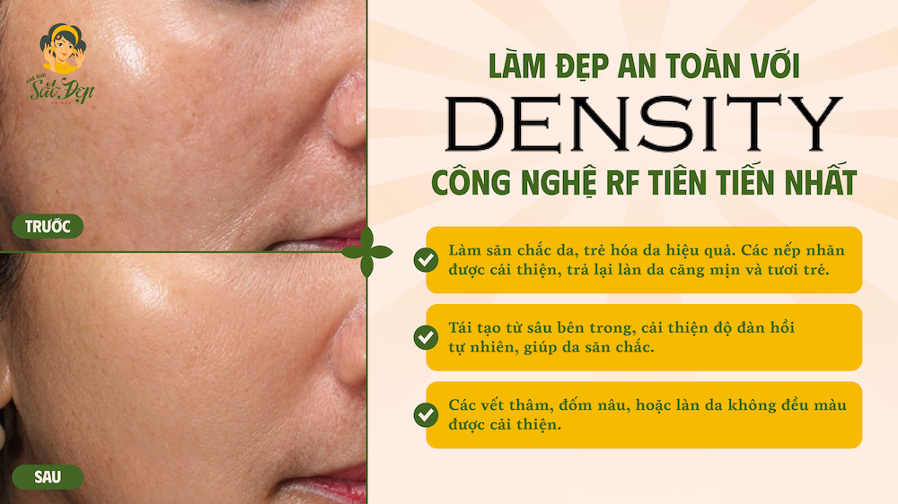 lam-dep-an-toan-voi-density-cong-nghe-rf-tien-tien