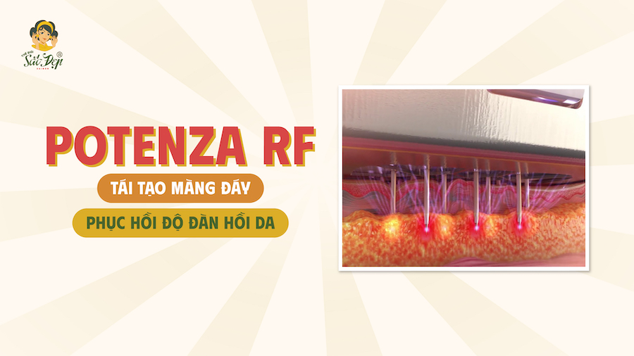 Potenza RF tái cấu trúc màng đáy 