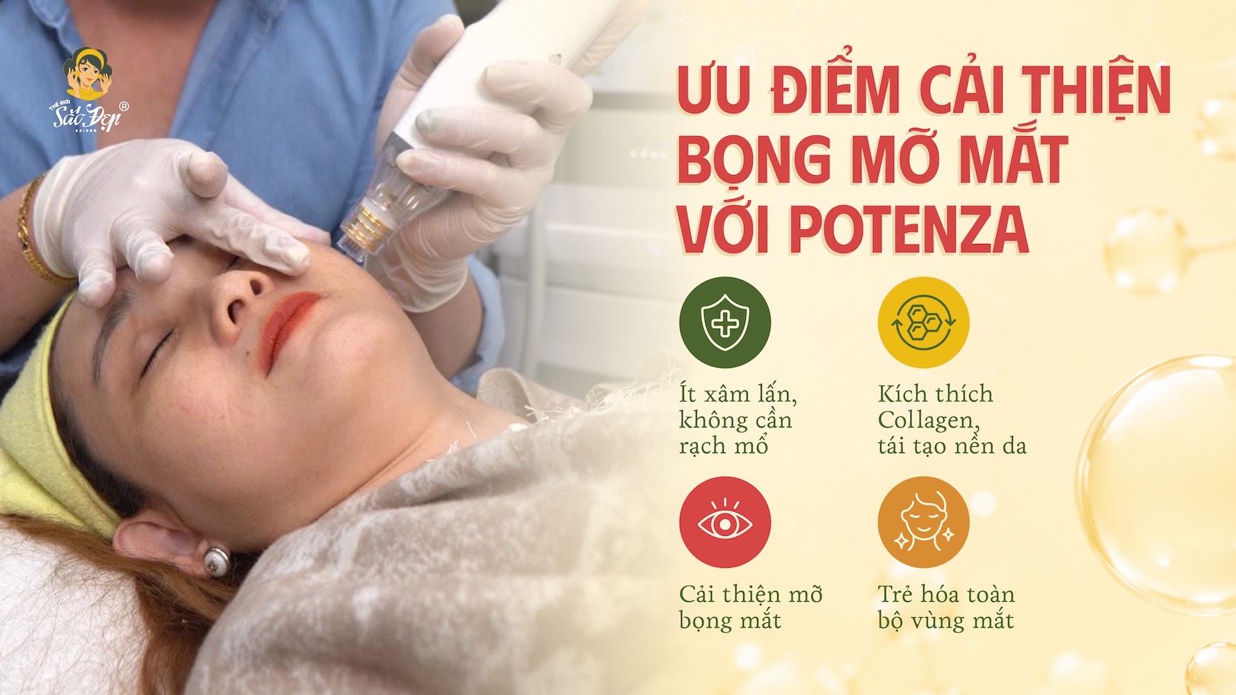 Ưu điểm cải thiện bọng mỡ mắt của Potenza