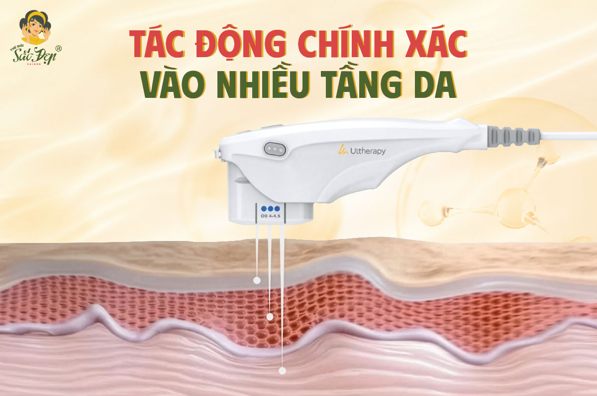 Ultherapy Prime tác động đa tầng da