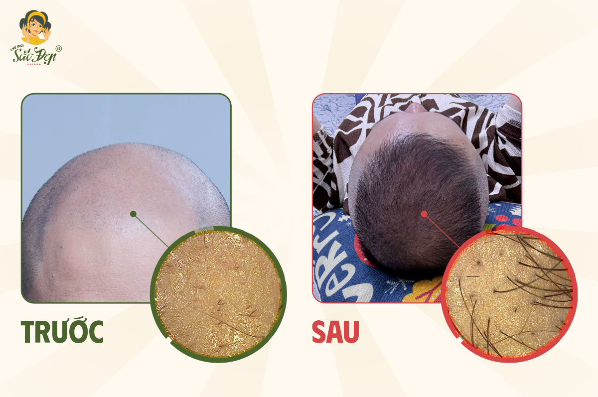 Kết quả sau 2 tháng thực hiện liệu trình của Bác sĩ Mập Hồng