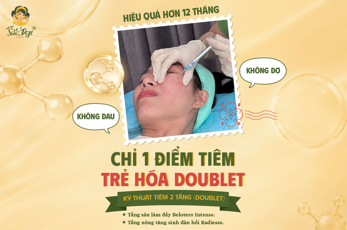Kỹ thuật Doublet - Trẻ hóa với 1 điểm tiêm